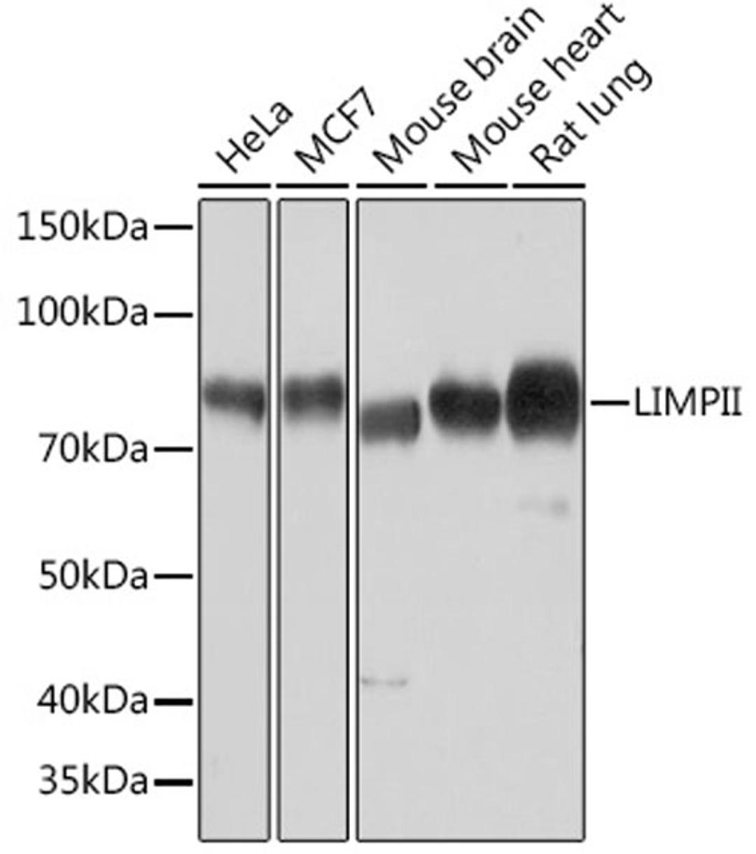 Western blot - LIMPII Rabbit mAb (A9185)