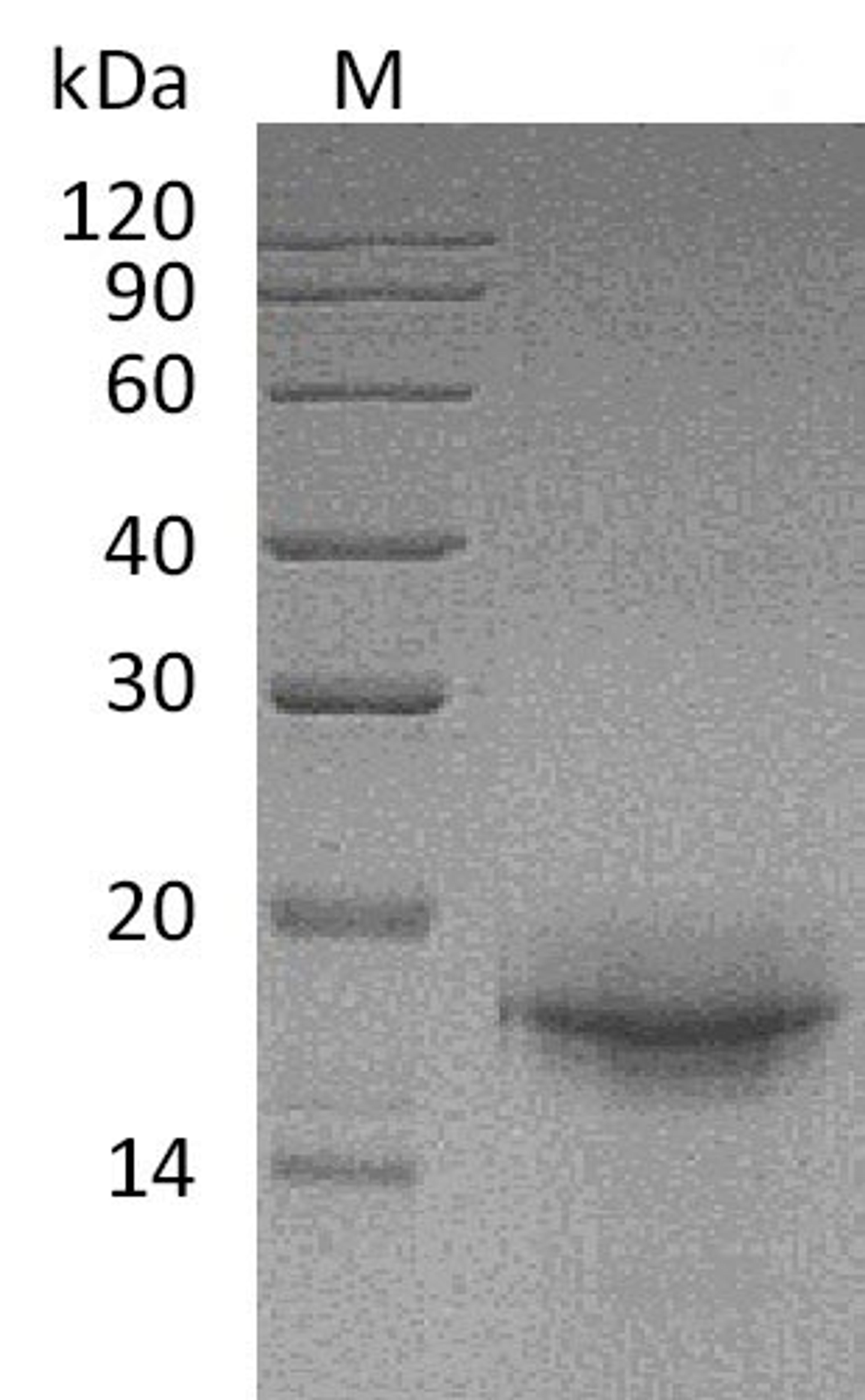 (Tris-Glycine gel) Discontinuous SDS-PAGE (reduced) with 5% enrichment gel and 15% separation gel.