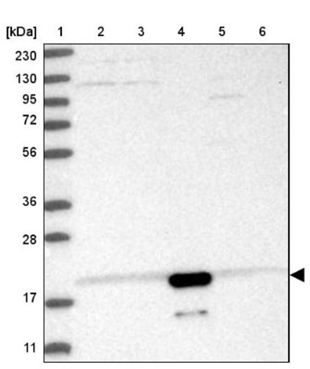 Western Blot: CNRIP1 Antibody [NBP1-86800] - Lane 1: Marker [kDa] 230, 130, 95, 72, 56, 36, 28, 17, 11<br/>Lane 2: Human cell line RT-4<br/>Lane 3: Human cell line U-251MG sp<br/>Lane 4: Human plasma (IgG/HSA depleted)<br/>Lane 5: Human liver tissue<br/>Lane 6: Human tonsil tissue