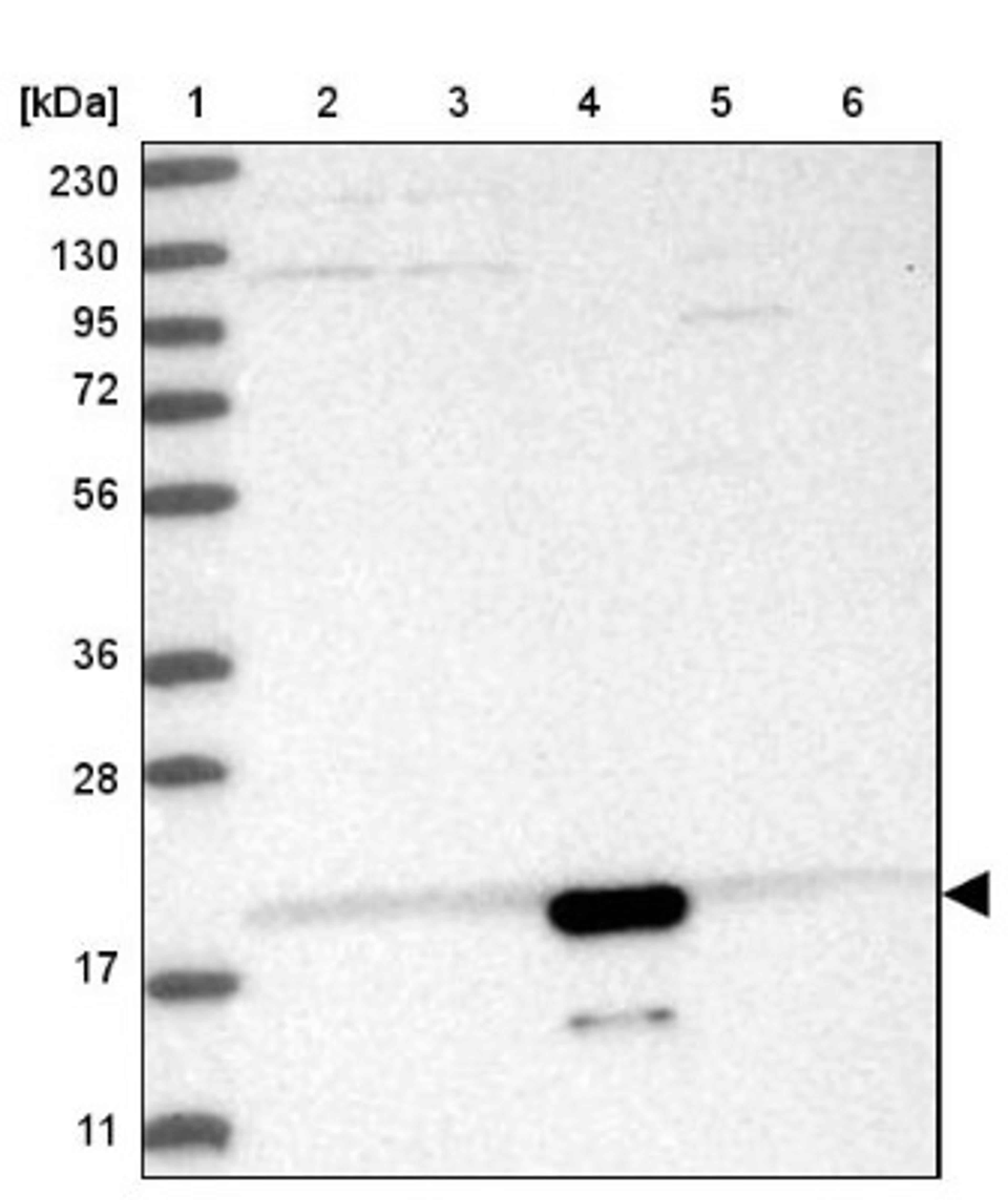 Western Blot: CNRIP1 Antibody [NBP1-86800] - Lane 1: Marker [kDa] 230, 130, 95, 72, 56, 36, 28, 17, 11<br/>Lane 2: Human cell line RT-4<br/>Lane 3: Human cell line U-251MG sp<br/>Lane 4: Human plasma (IgG/HSA depleted)<br/>Lane 5: Human liver tissue<br/>Lane 6: Human tonsil tissue