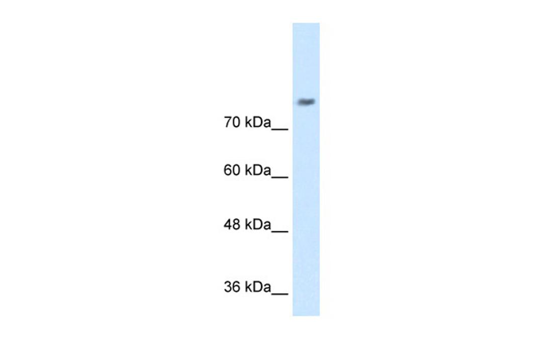 Antibody used in WB on Human Jurkat 0.2-1 ug/ml.