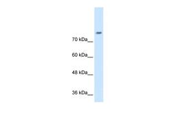 Antibody used in WB on Human Jurkat 0.2-1 ug/ml.