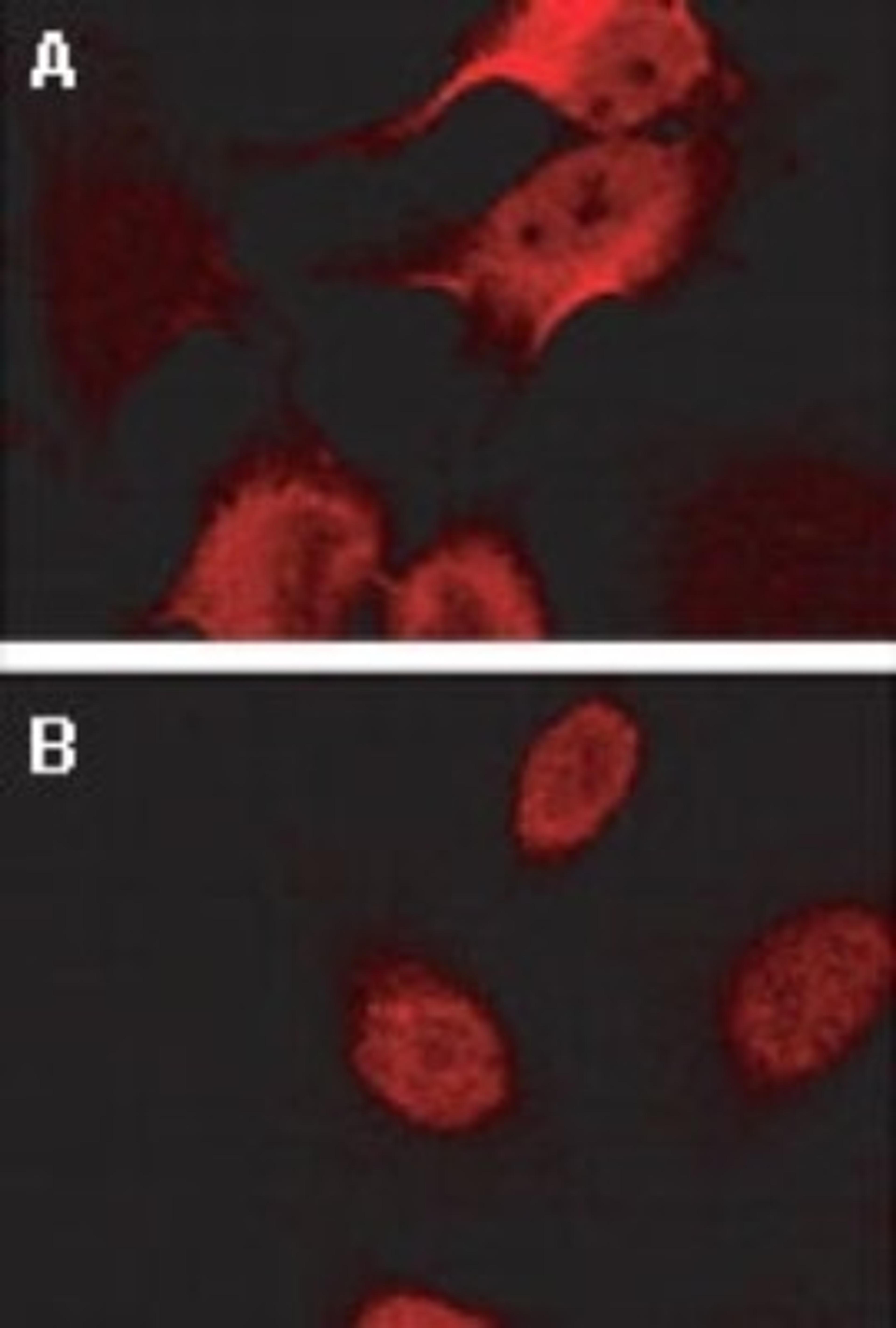 Immunocytochemistry/Immunofluorescence: BAG2 Antibody [NB100-56087] - Immunofluorescence confocal microscopy of BAG-2 using NB100-56087 at 1:2000. HeLa cells stably transfected with Myc-CHIP (carboxyl terminus of Hsp70-interacting protein) and growing on coverslips were left untreated (A) or heat shocked at 42 degrees for 30 min (B). Cells were fixed with 3.7% paraformaldehyde, permeabilized with 0.5% Triton X-100 prior to antibody staining. BAG-2 localized to the cytoplasm of untreated cells, and to the nucleus of cells subjected to heat shock. Please refer to Dai et al (2005) for additional information on HeLa cells stably transfected with Myc-CHIP.