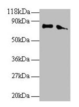 Western blot. All lanes: ERP29 antibody at 2µg/ml. Lane 1: EC109 whole cell lysate. Lane 2: 293T whole cell lysate. Secondary. Goat polyclonal to rabbit IgG at 1/15000 dilution. Predicted band size: 29, 6 kDa. Observed band size: 80 kDa