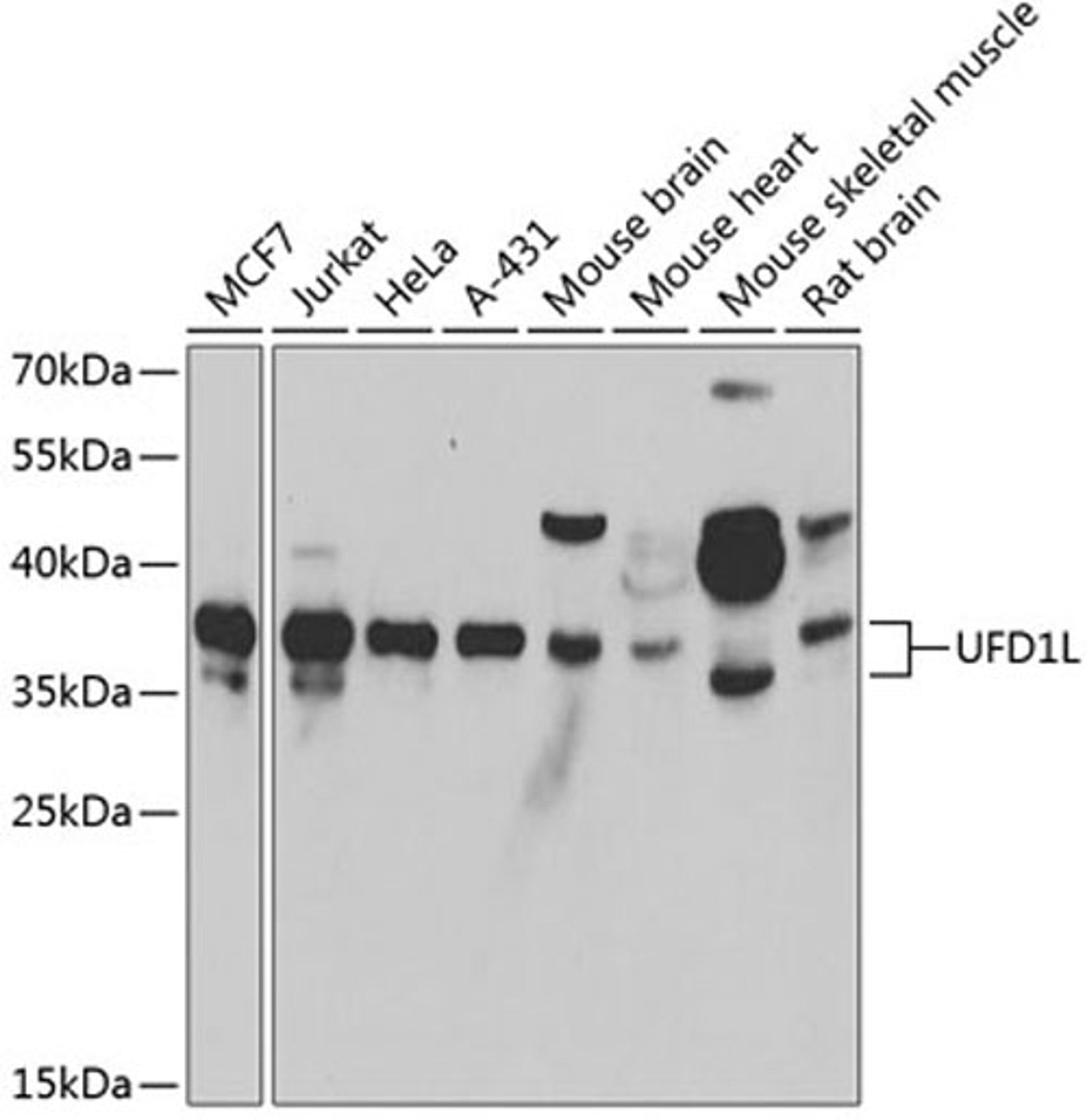 Western blot - UFD1L antibody (A6783)