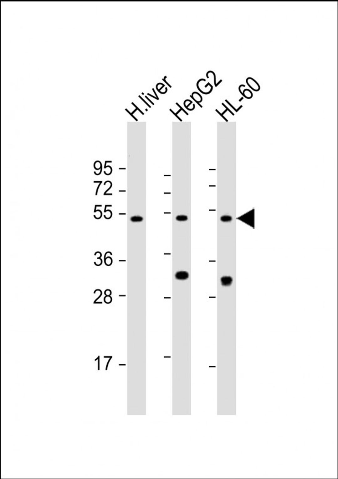 Western Blot at 1:2000 dilution Lane 1: human liver lysate Lane 2: HepG2 whole cell lysate Lane 3: HL-60 whole cell lysate Lysates/proteins at 20 ug per lane.