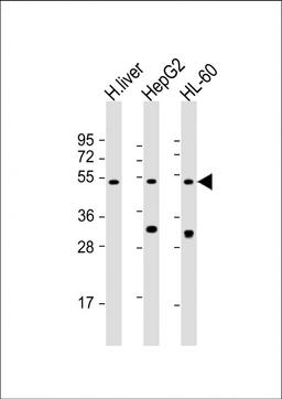 Western Blot at 1:2000 dilution Lane 1: human liver lysate Lane 2: HepG2 whole cell lysate Lane 3: HL-60 whole cell lysate Lysates/proteins at 20 ug per lane.