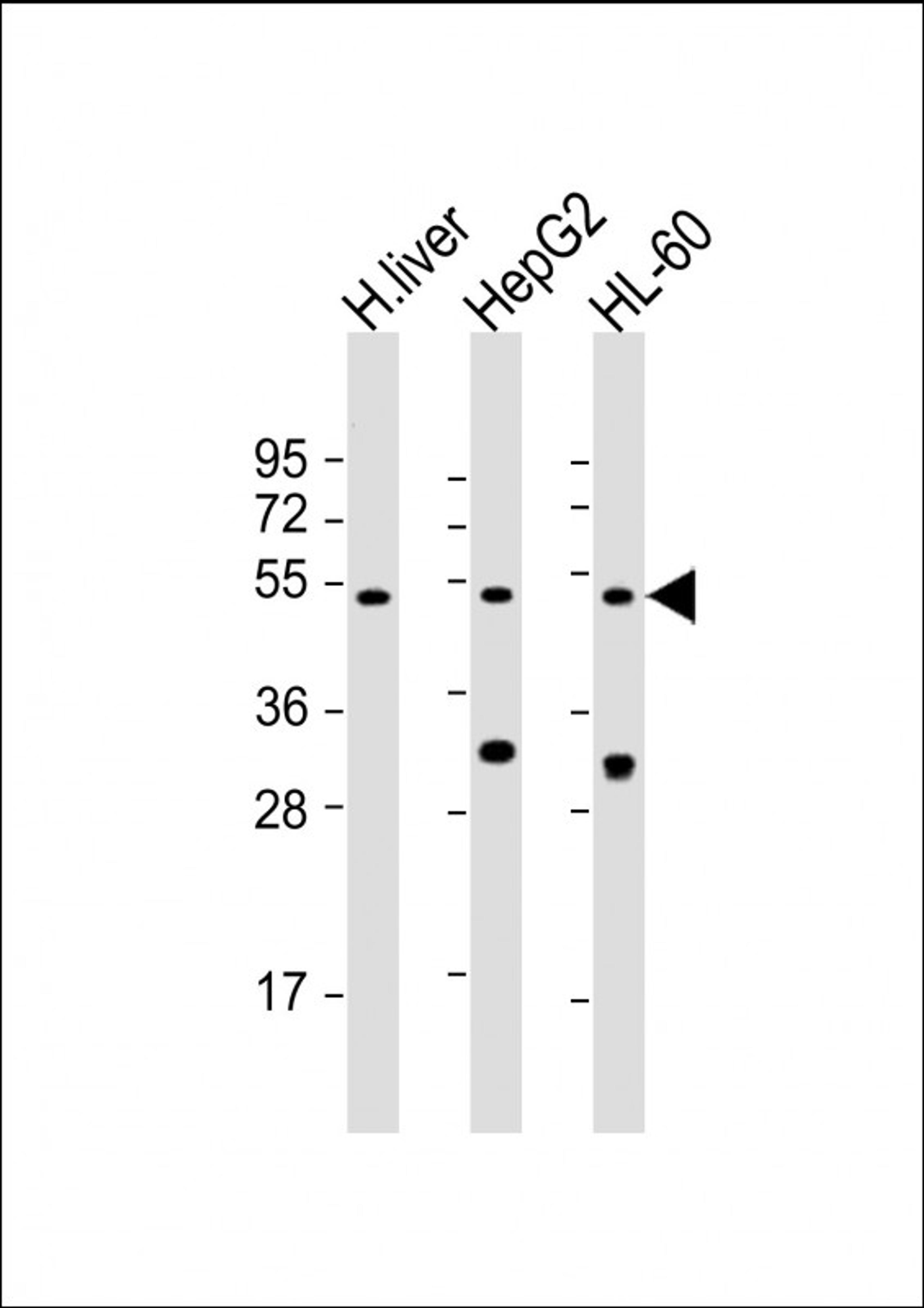 Western Blot at 1:2000 dilution Lane 1: human liver lysate Lane 2: HepG2 whole cell lysate Lane 3: HL-60 whole cell lysate Lysates/proteins at 20 ug per lane.