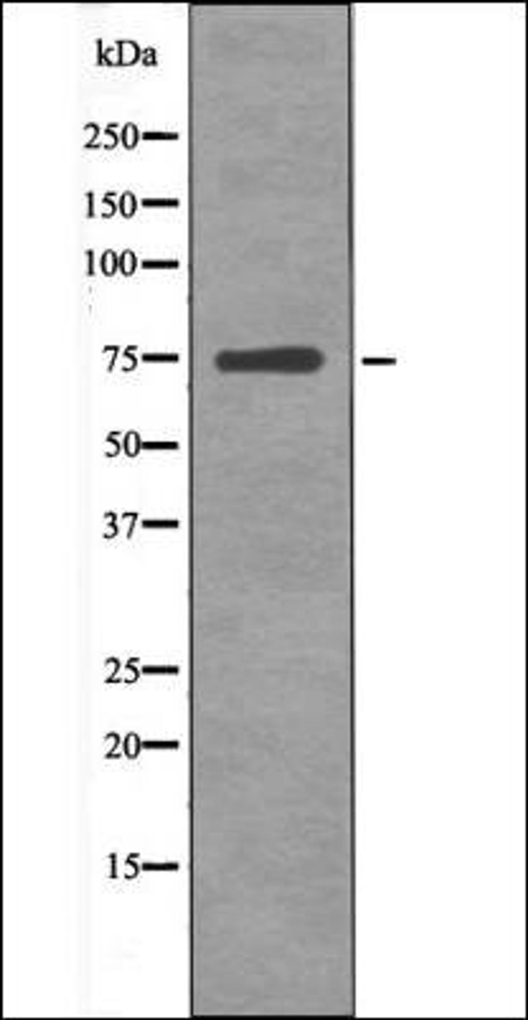 Western blot analysis of HeLa whole cell lysates using NuaK1 -Phospho-Ser600- antibody