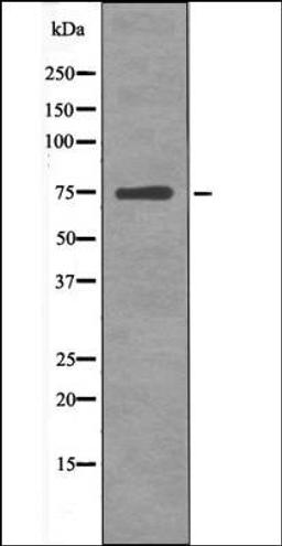 Western blot analysis of HeLa whole cell lysates using NuaK1 -Phospho-Ser600- antibody