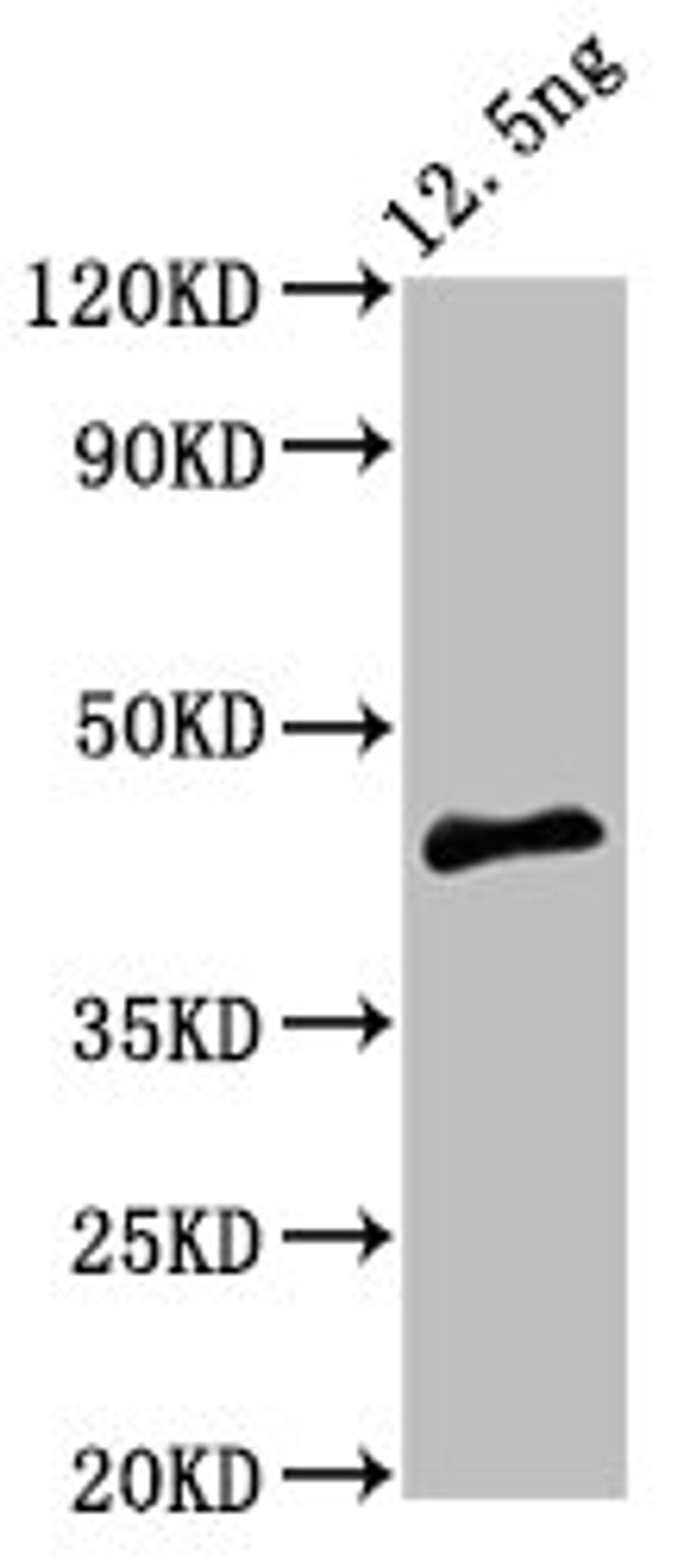Western Blot. Positive WB detected in Recombinant protein. All lanes: PMRT15 antibody at 5ug/ml. Secondary. Goat polyclonal to rabbit IgG at 1/50000 dilution. Predicted band size: 44 kDa. Observed band size: 44 kDa. 