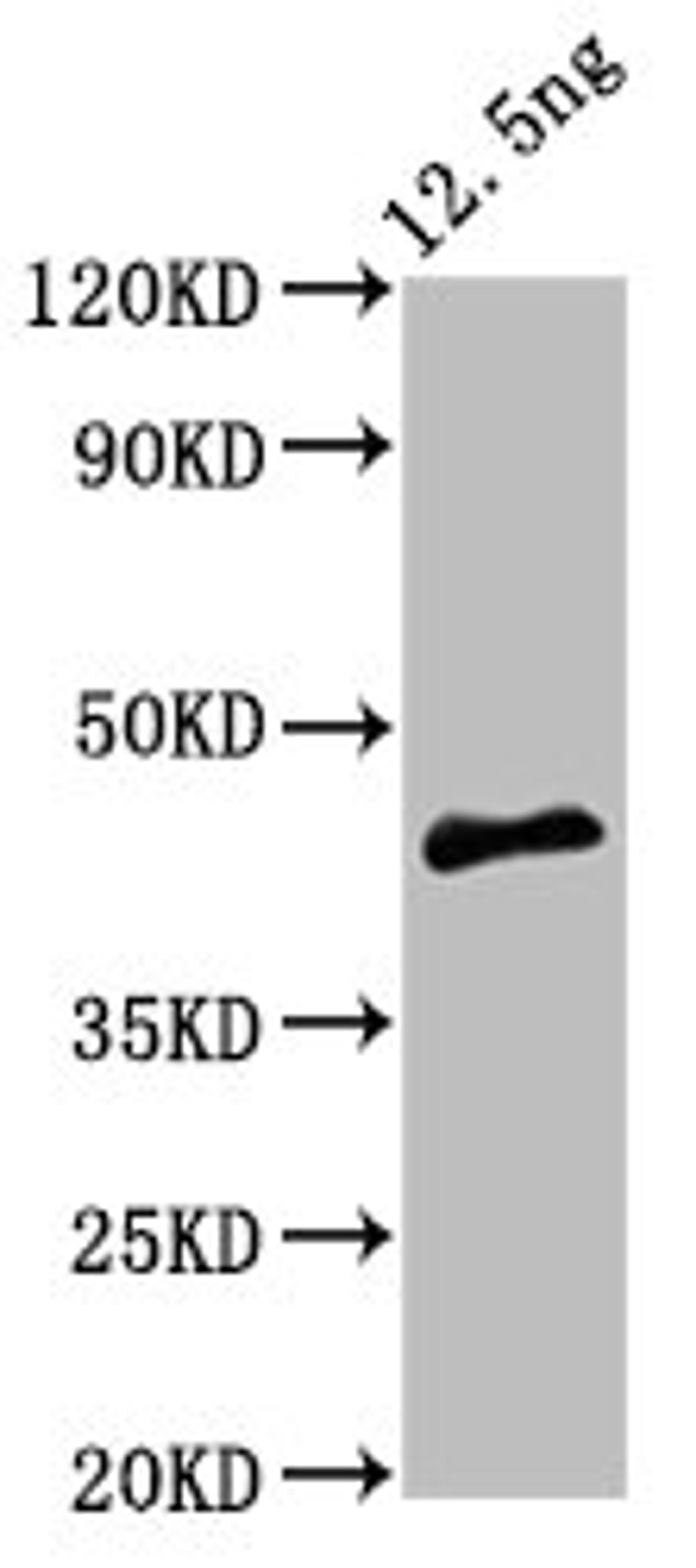 Western Blot. Positive WB detected in Recombinant protein. All lanes: PMRT15 antibody at 5ug/ml. Secondary. Goat polyclonal to rabbit IgG at 1/50000 dilution. Predicted band size: 44 kDa. Observed band size: 44 kDa. 