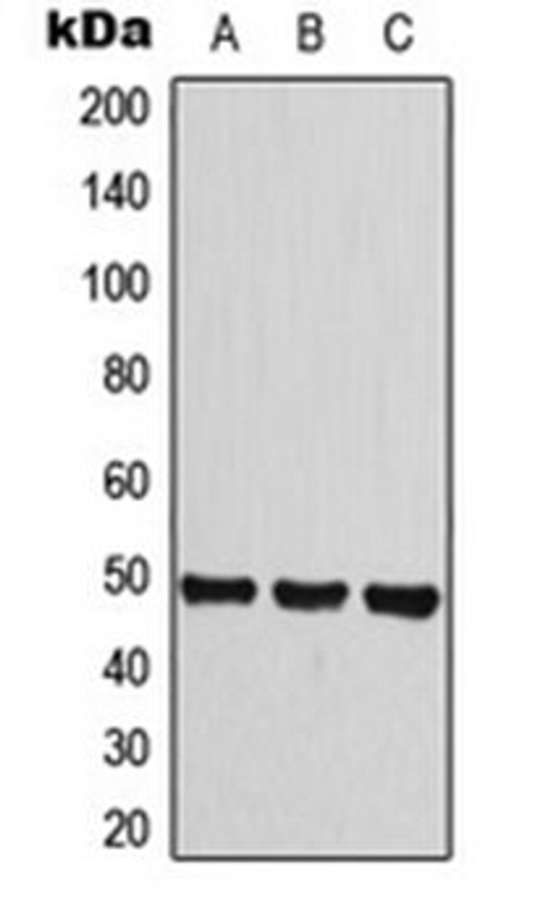 Western blot analysis of HeLa (Lane 1), A549 (Lane 2), Raw264.7 (Lane 3) whole cell lysates using Histamine H3 Receptor antibody