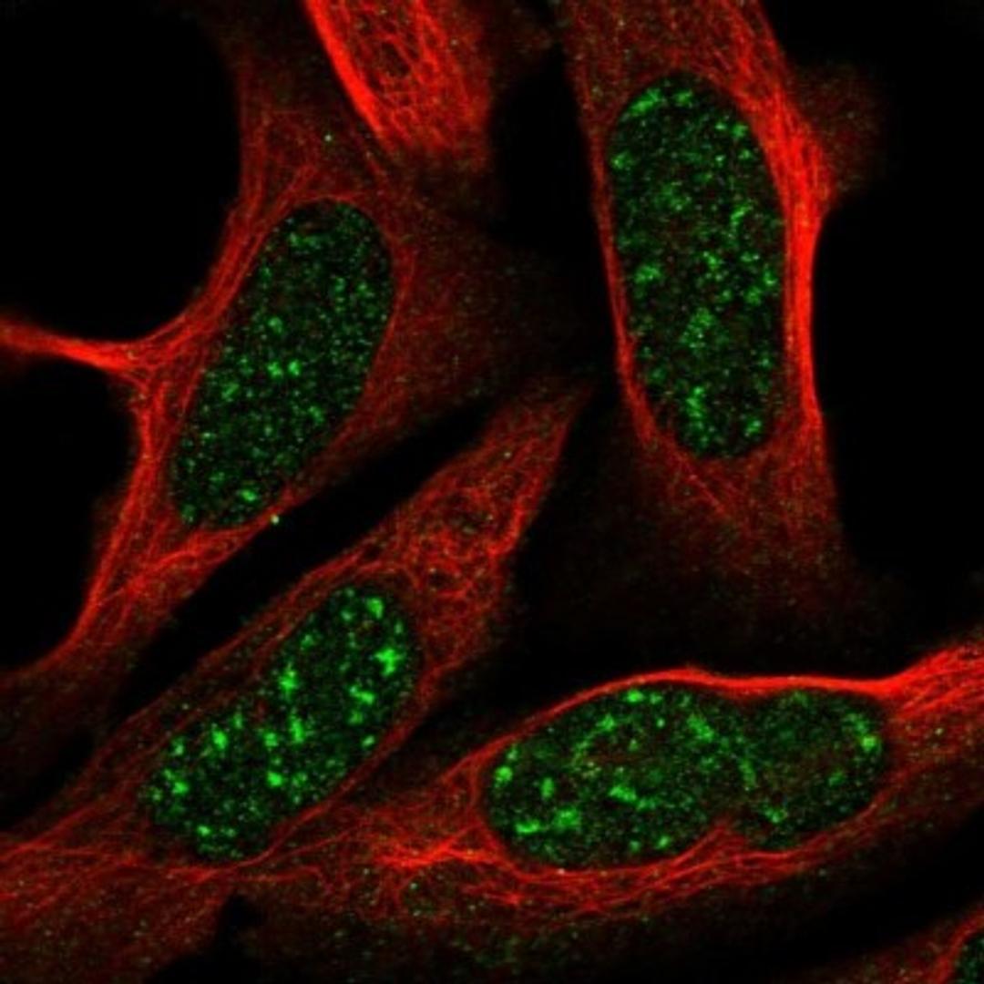 Immunocytochemistry/Immunofluorescence: CRIP3 Antibody [NBP1-88762] - Staining of human cell line U-2 OS shows positivity in nucleoli & nucleus but not nucleoli.