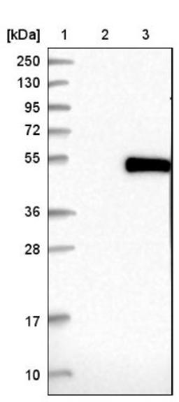 Western Blot: TSSK1 Antibody [NBP1-83883] - Lane 1: Marker [kDa] 250, 130, 95, 72, 55, 36, 28, 17, 10<br/>Lane 2: Negative control (vector only transfected HEK293T lysate)<br/>Lane 3: Over-expression lysate (Co-expressed with a C-terminal myc-DDK tag (~3.1 kDa) in mammalian HEK293T cells, LY403140)