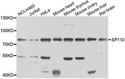 Western blot analysis of extracts of various cell lines using SP110 antibody