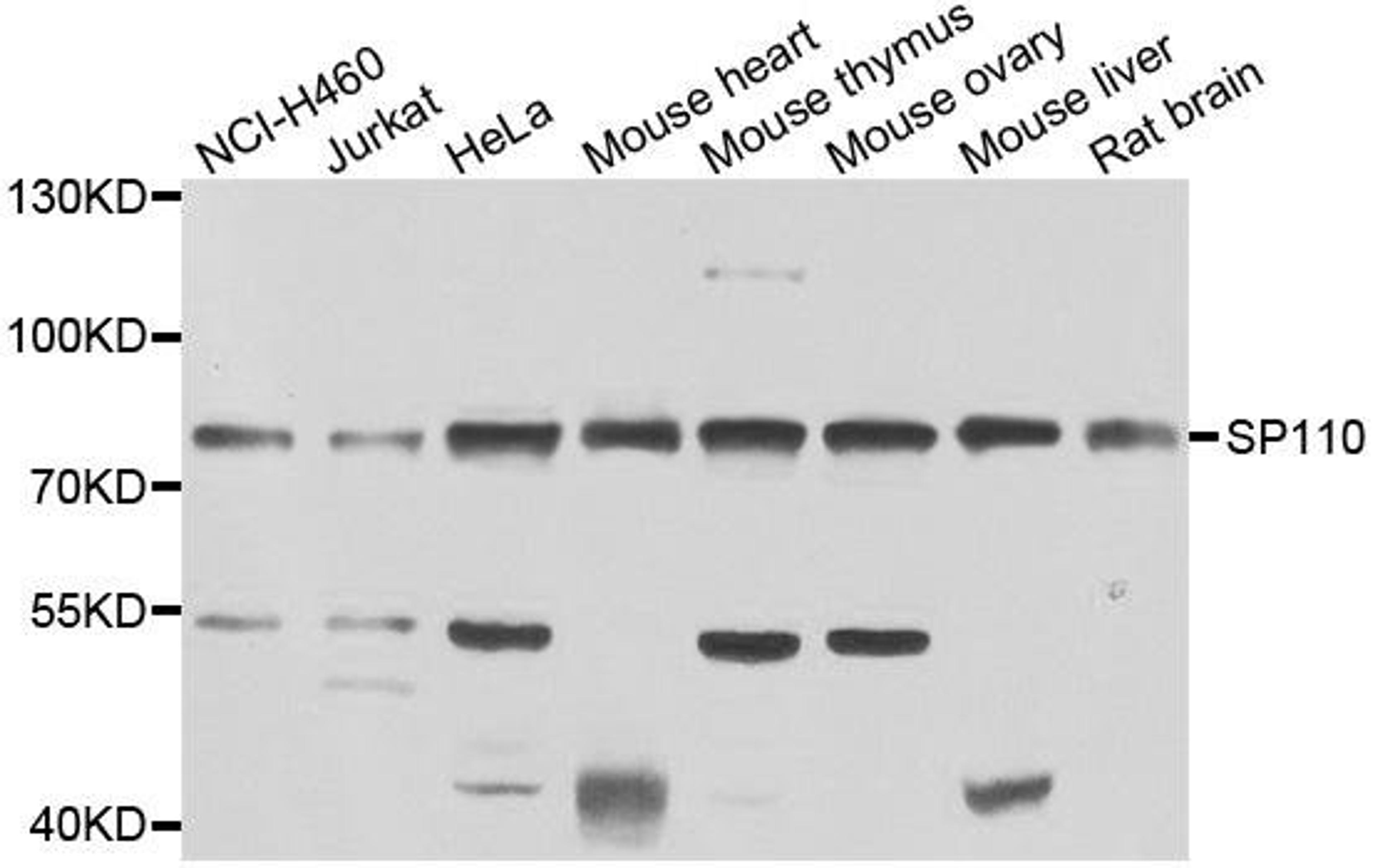 Western blot analysis of extracts of various cell lines using SP110 antibody