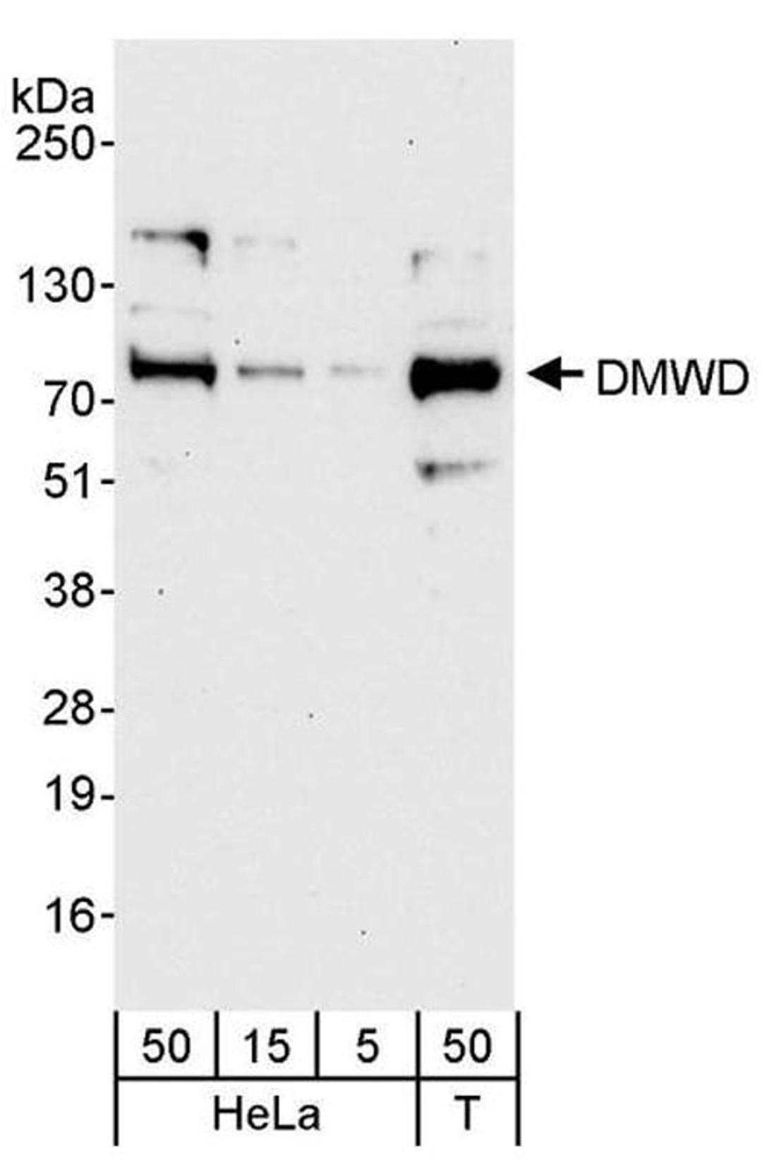 Detection of human DMWD by WB.