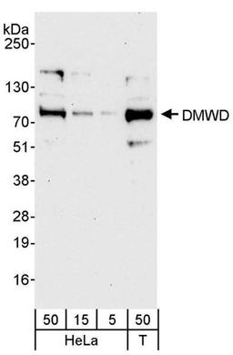 Detection of human DMWD by WB.