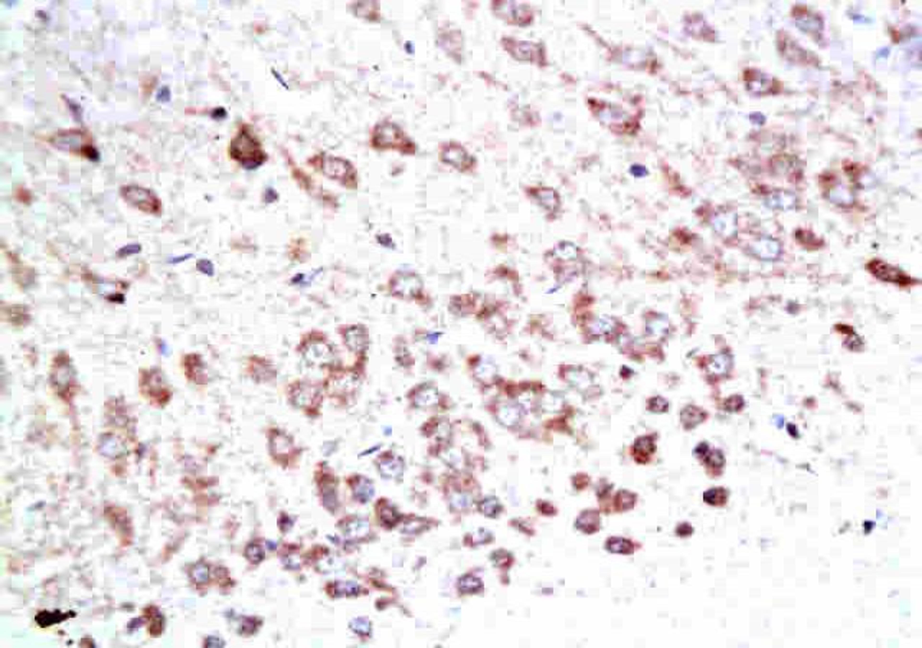 Immunohistochemical analysis of paraffin-embedded rat brain tissue using Mst1 (phospho-Thr183) antibody.