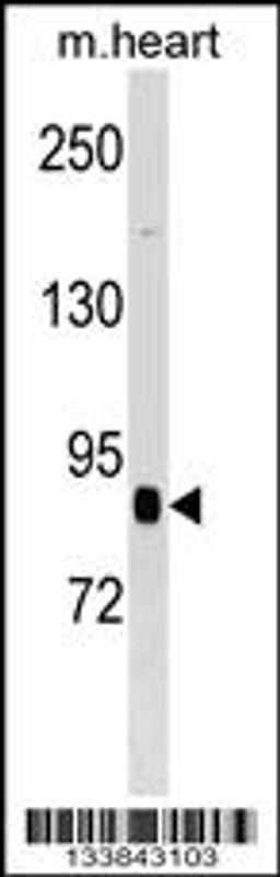 Western blot analysis in mouse heart tissue lysates (35ug/lane).