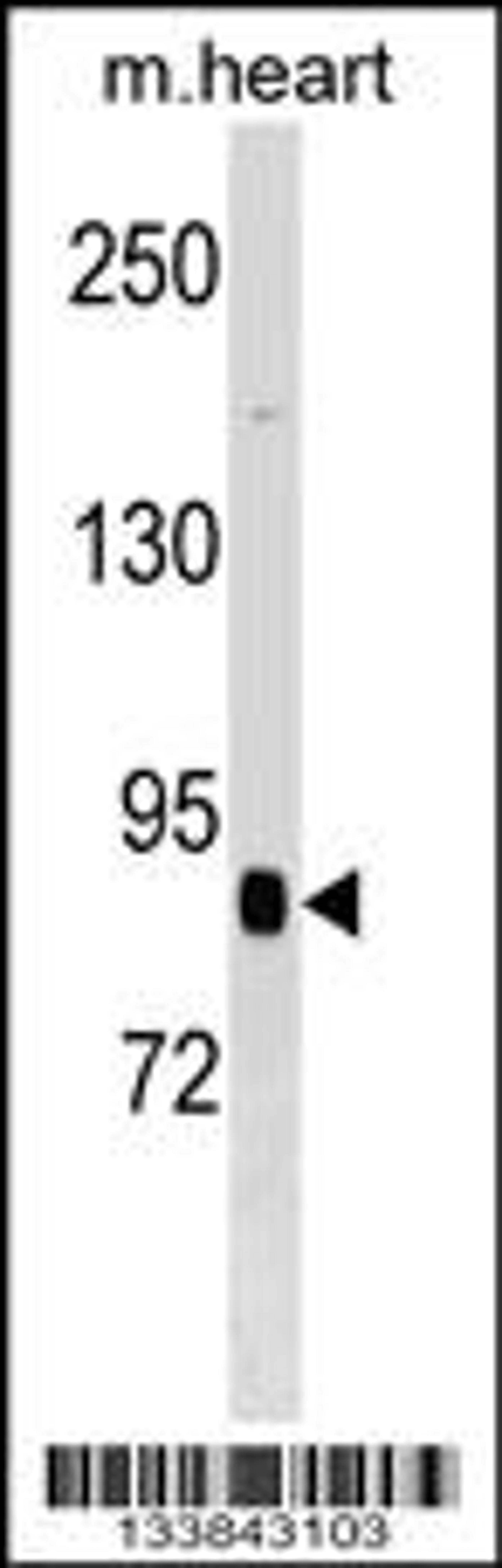 Western blot analysis in mouse heart tissue lysates (35ug/lane).