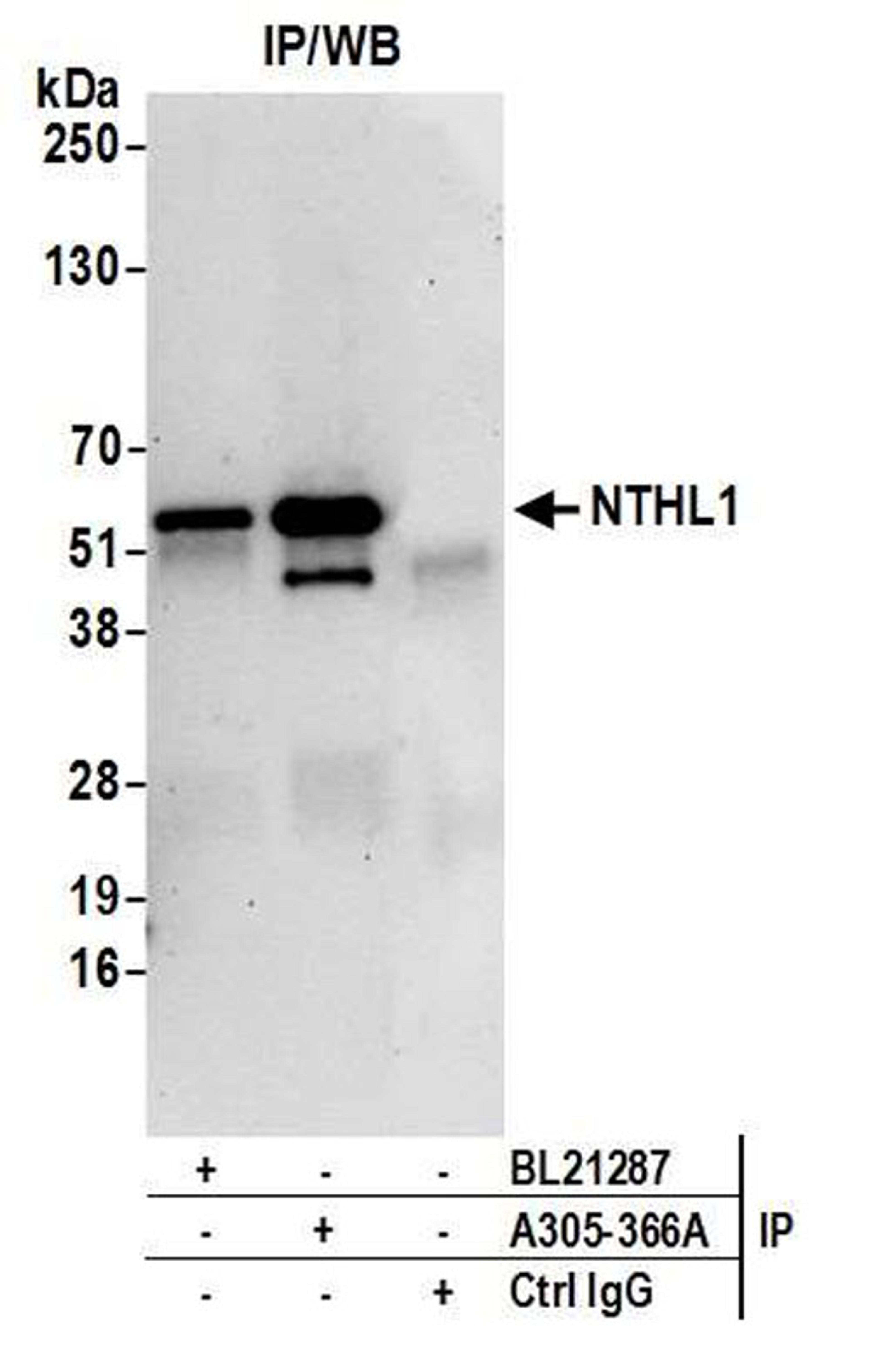 Detection of human NTHL1 by WB of IP.