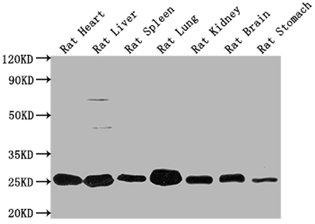 Western Blot. Positive WB detected in: Rat Heart tissue, Rat Liver tissue, Rat Spleen tissue, Rat Lung tissue, Rat Kidney tissue, Rat Brain tissue, Rat Stomach tissue. All lanes: Apoa1 antibody at 1:2000. Secondary. Goat polyclonal to rabbit IgG at 1/50000 dilution. Predicted band size: 31 kDa. Observed band size: 31 kDa. 
