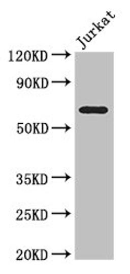 Western Blot. Positive WB detected in: Jurkat whole cell lysate. All lanes: SLC38A9 antibody at 3.5ug/ml. Secondary. Goat polyclonal to rabbit IgG at 1/50000 dilution. Predicted band size: 64, 53, 57 kDa. Observed band size: 64 kDa. 