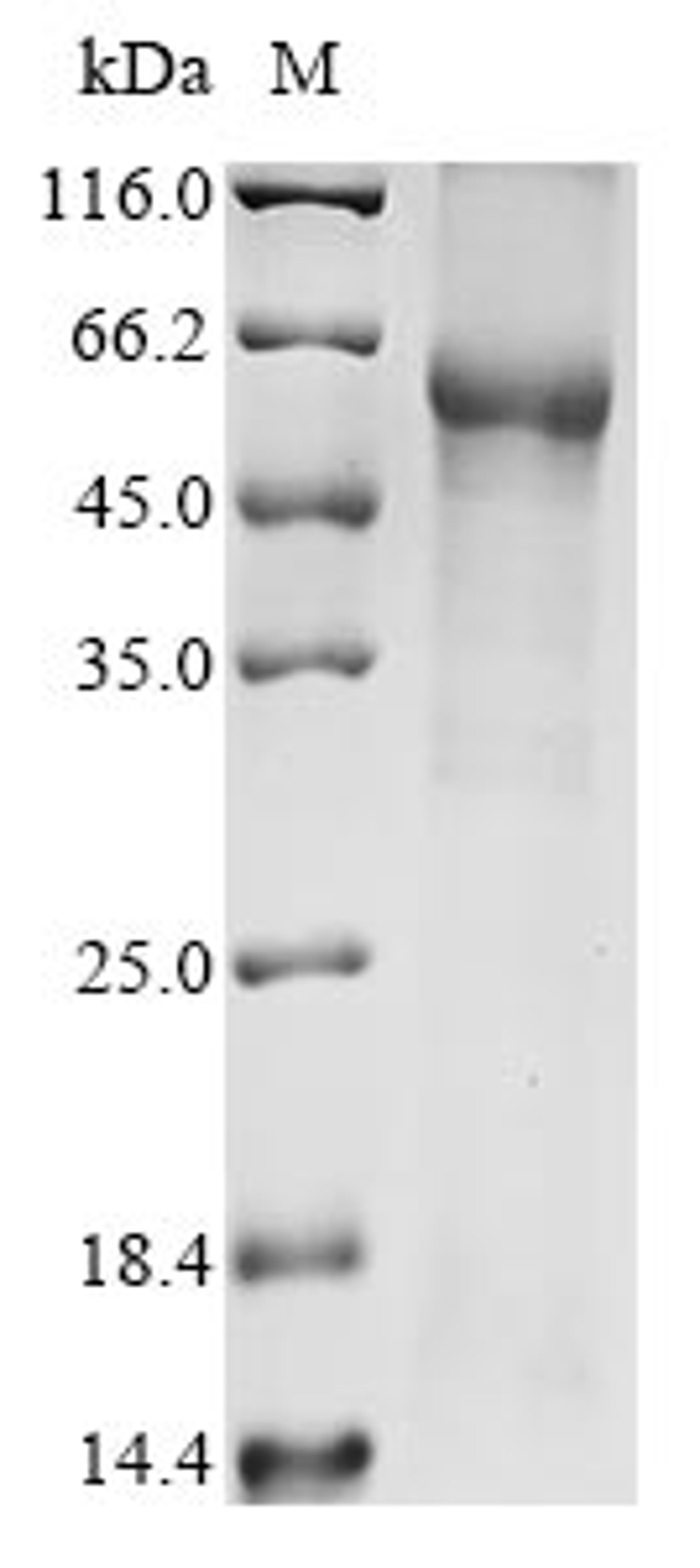 (Tris-Glycine gel) Discontinuous SDS-PAGE (reduced) with 5% enrichment gel and 15% separation gel.