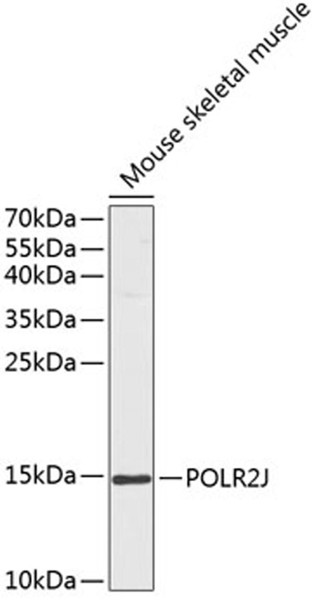 Western blot - POLR2J antibody (A13627)