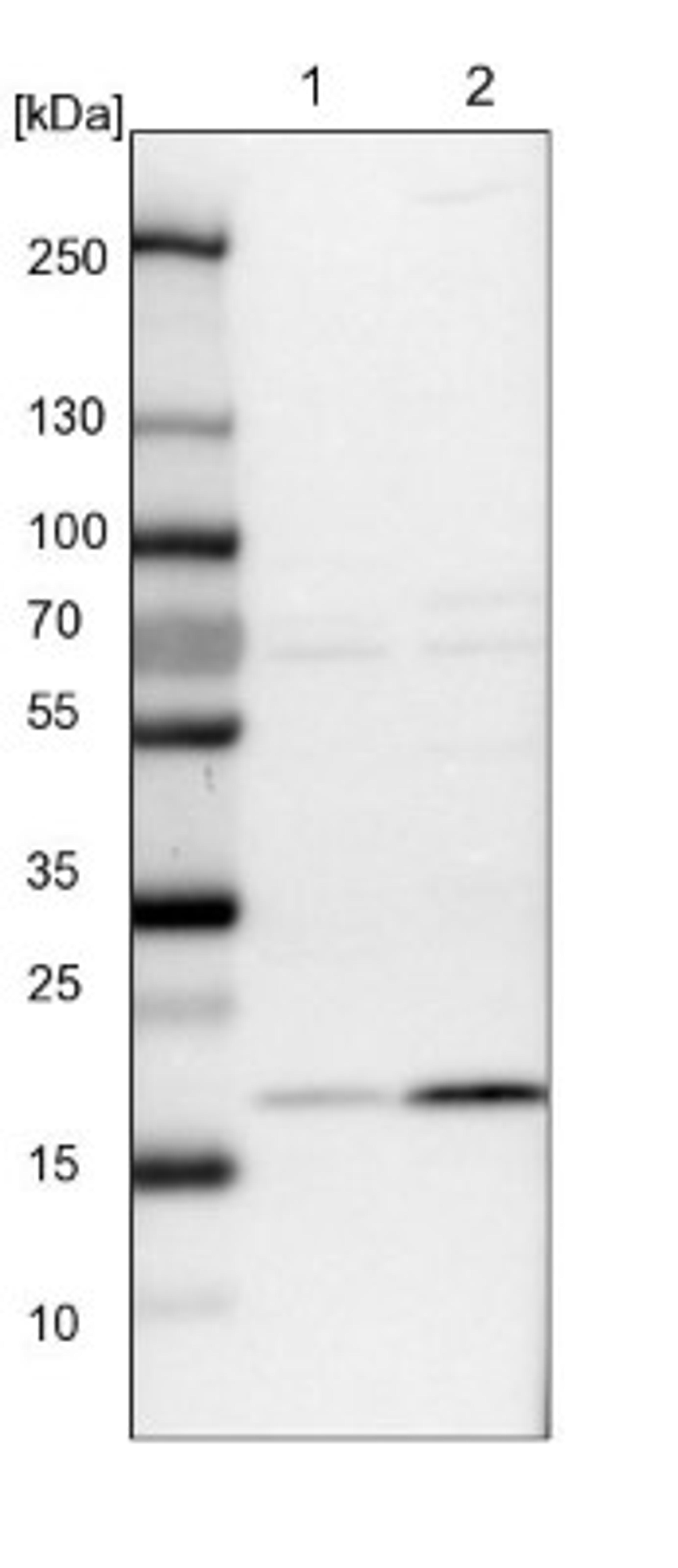 Western Blot: TMEM199 Antibody [NBP1-88467] - Lane 1: NIH-3T3 cell lysate (Mouse embryonic fibroblast cells)<br/>Lane 2: NBT-II cell lysate (Rat Wistar bladder tumour cells)