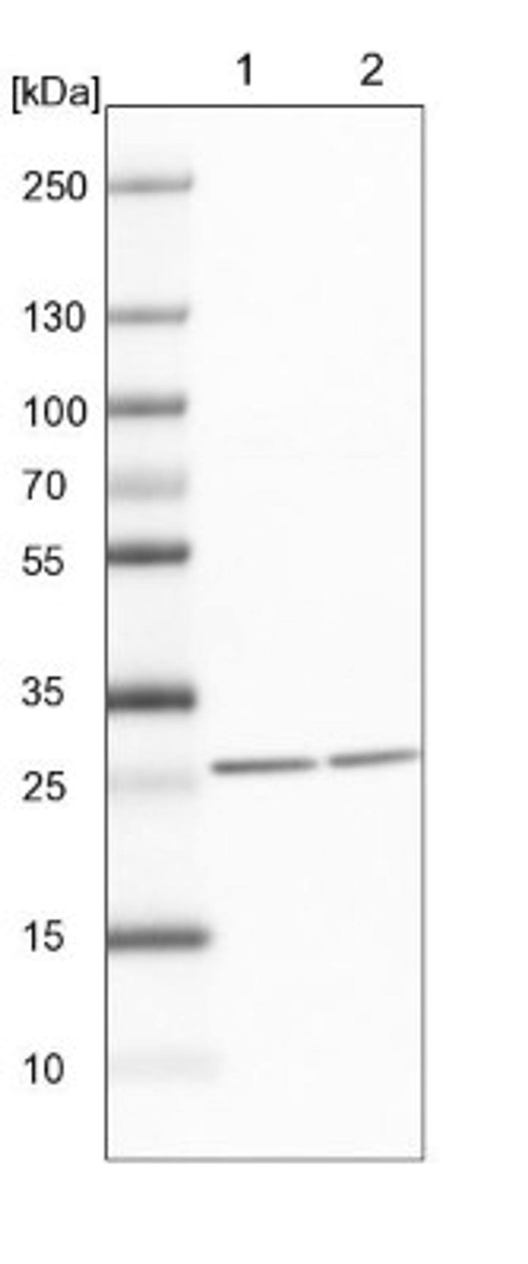 Western Blot: Histamine N-Methyltransferase/HNMT Antibody [NBP1-89495] - Lane 1: NIH-3T3 cell lysate (Mouse embryonic fibroblast cells)<br/>Lane 2: NBT-II cell lysate (Rat Wistar bladder tumour cells)