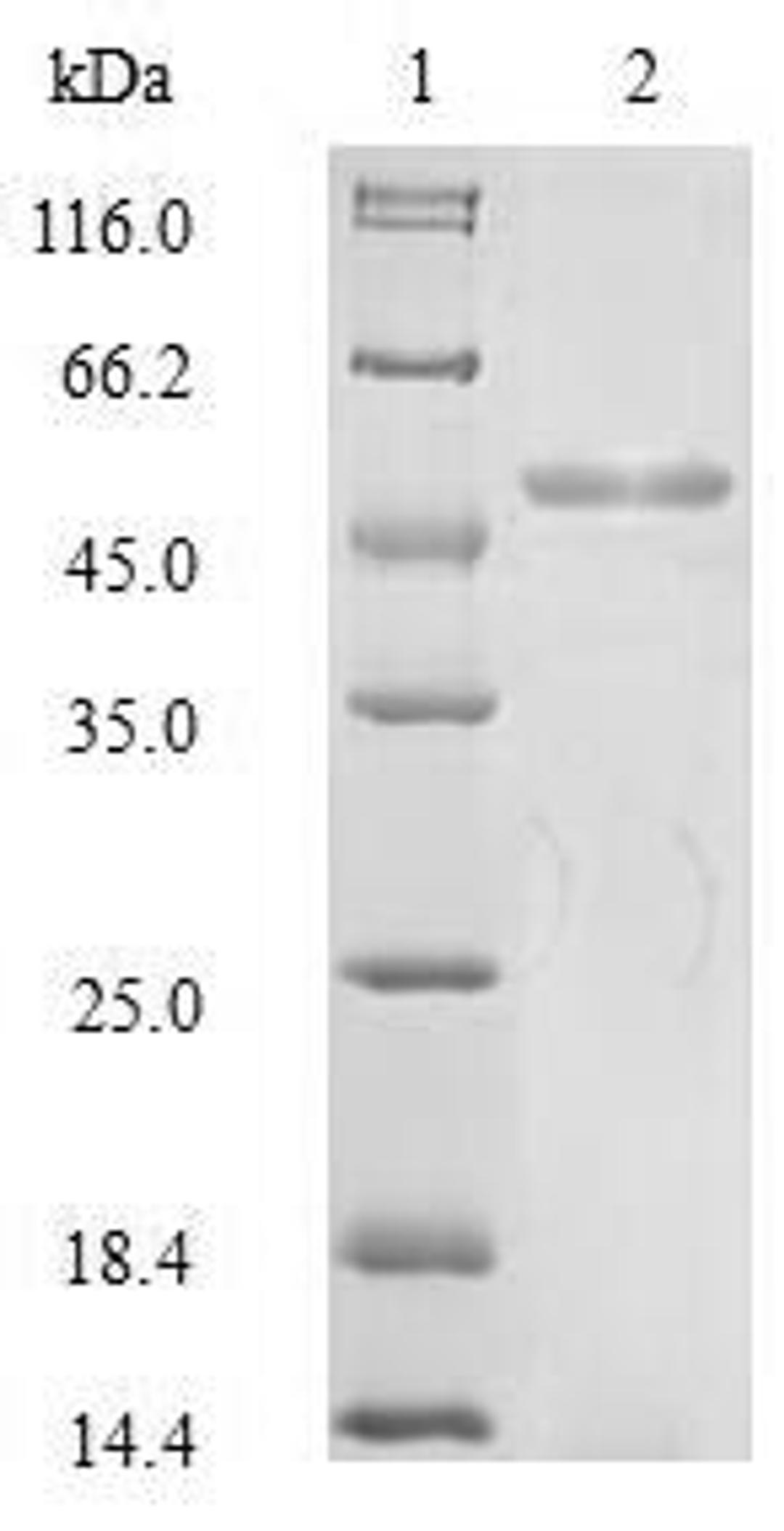 (Tris-Glycine gel) Discontinuous SDS-PAGE (reduced) with 5% enrichment gel and 15% separation gel.