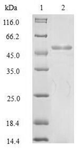 (Tris-Glycine gel) Discontinuous SDS-PAGE (reduced) with 5% enrichment gel and 15% separation gel.