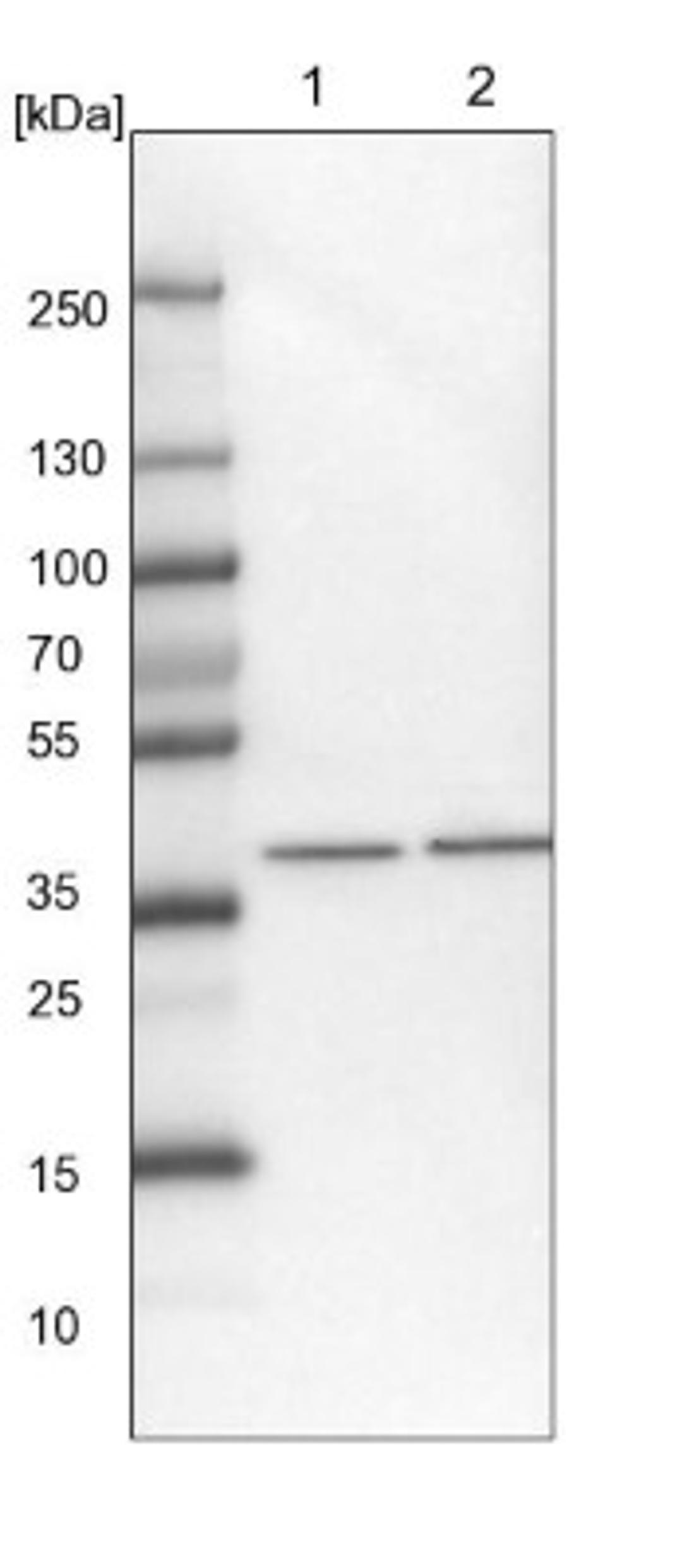 Western Blot: AGXT2L2 Antibody [NBP1-81190] - Lane 1: NIH-3T3 cell lysate (Mouse embryonic fibroblast cells)<br/>Lane 2: NBT-II cell lysate (Rat Wistar bladder tumour cells)