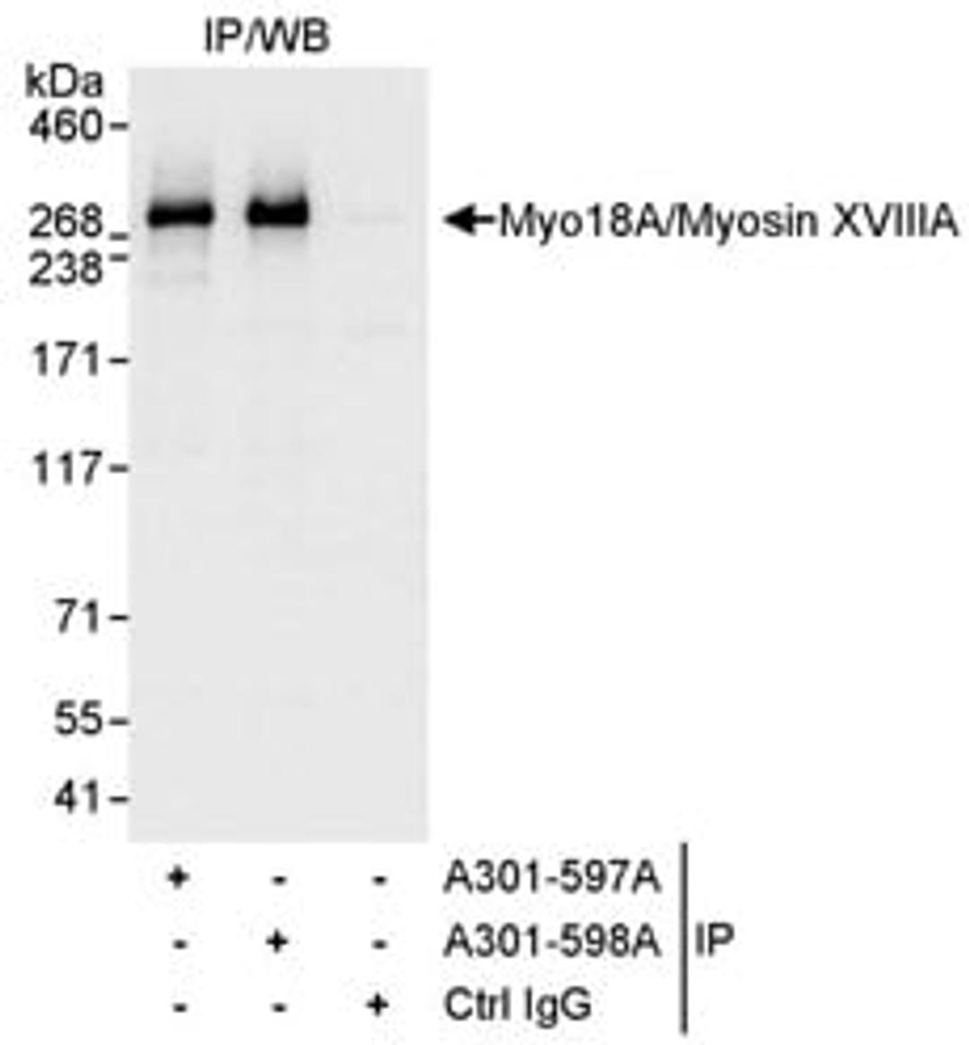 Detection of human Myo18A/Myosin XVIIIA by western blot of immunoprecipitates.