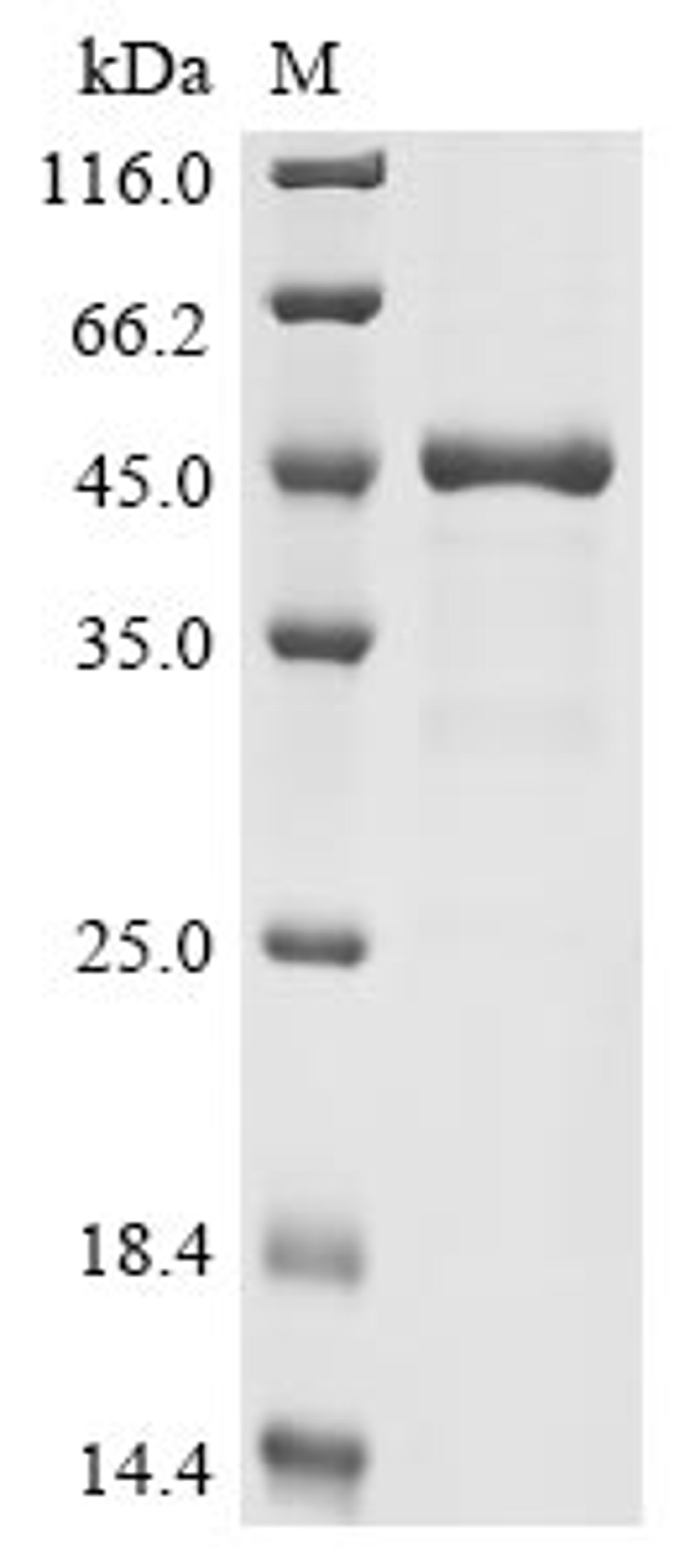 (Tris-Glycine gel) Discontinuous SDS-PAGE (reduced) with 5% enrichment gel and 15% separation gel.