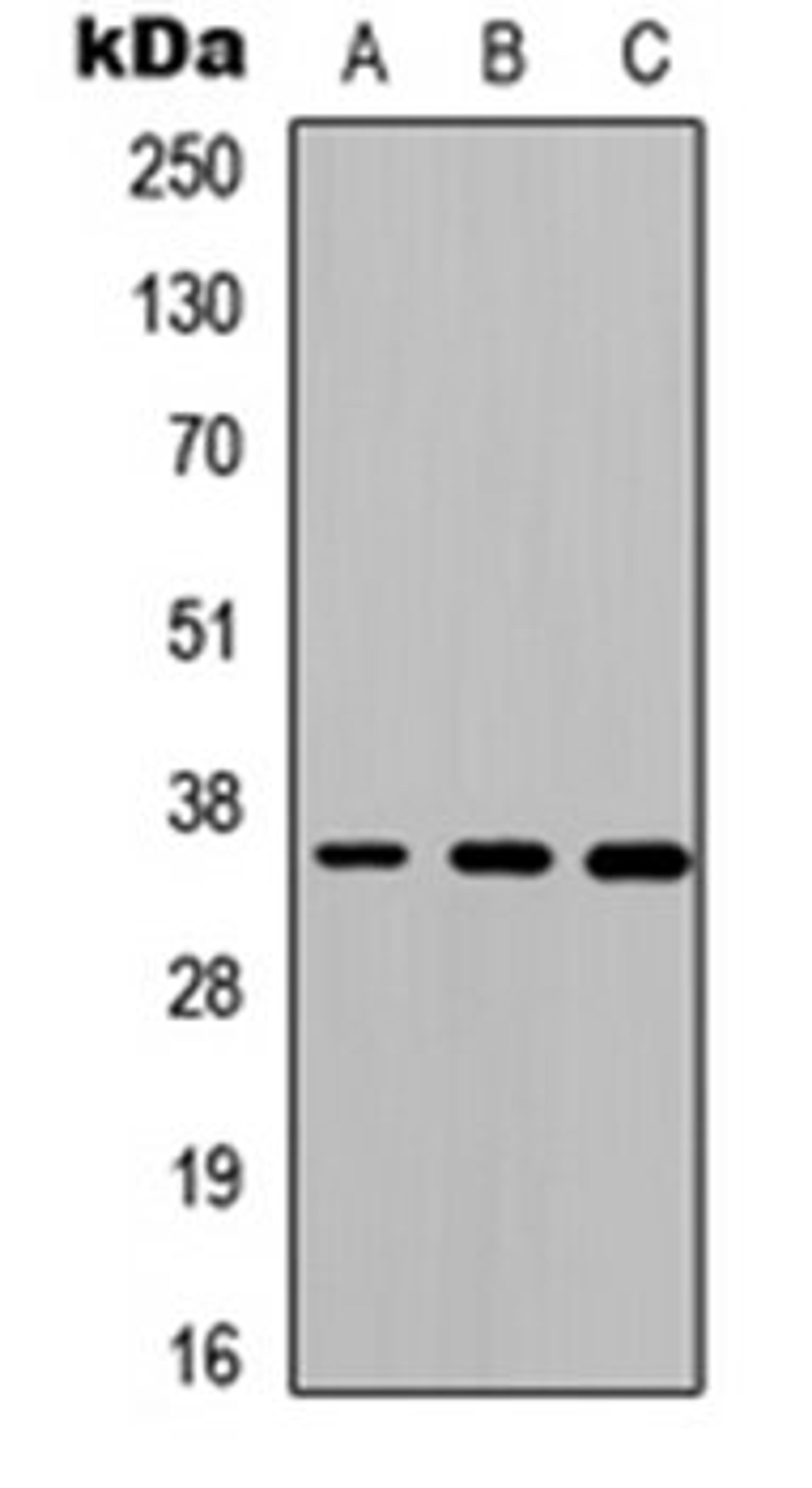 Western blot analysis of HEK293T (Lane 1), Raw264.7 (Lane 2), H9C2 (Lane 3) whole cell lysates using Cathepsin O antibody