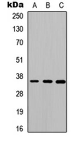 Western blot analysis of HEK293T (Lane 1), Raw264.7 (Lane 2), H9C2 (Lane 3) whole cell lysates using Cathepsin O antibody