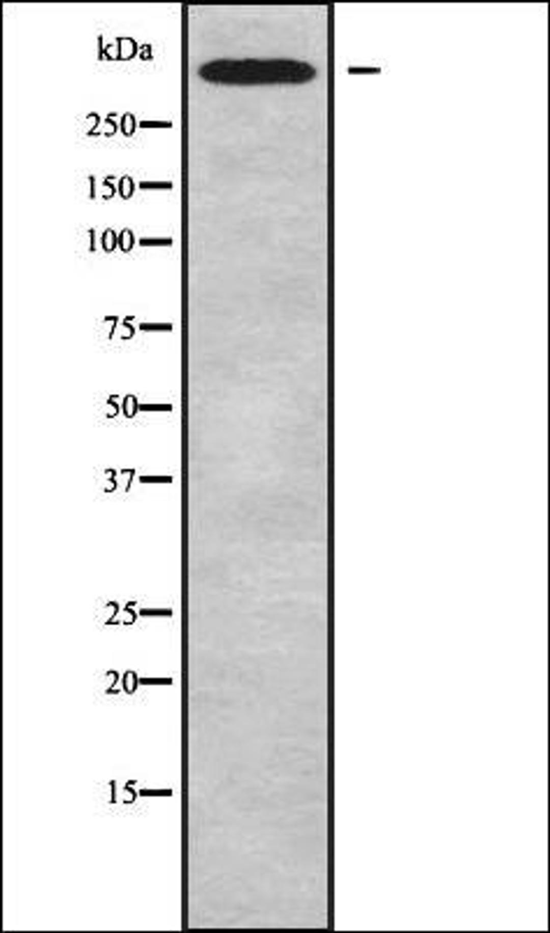 Western blot analysis of MCF7 whole cell lysates using CHD6 antibody