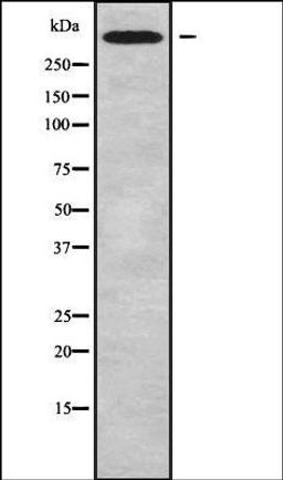 Western blot analysis of MCF7 whole cell lysates using CHD6 antibody