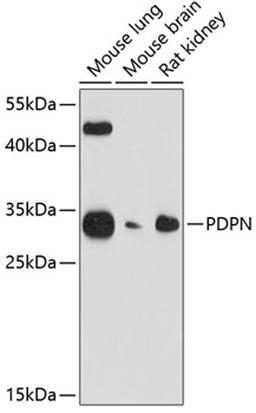 Western blot - PDPN antibody (A13261)