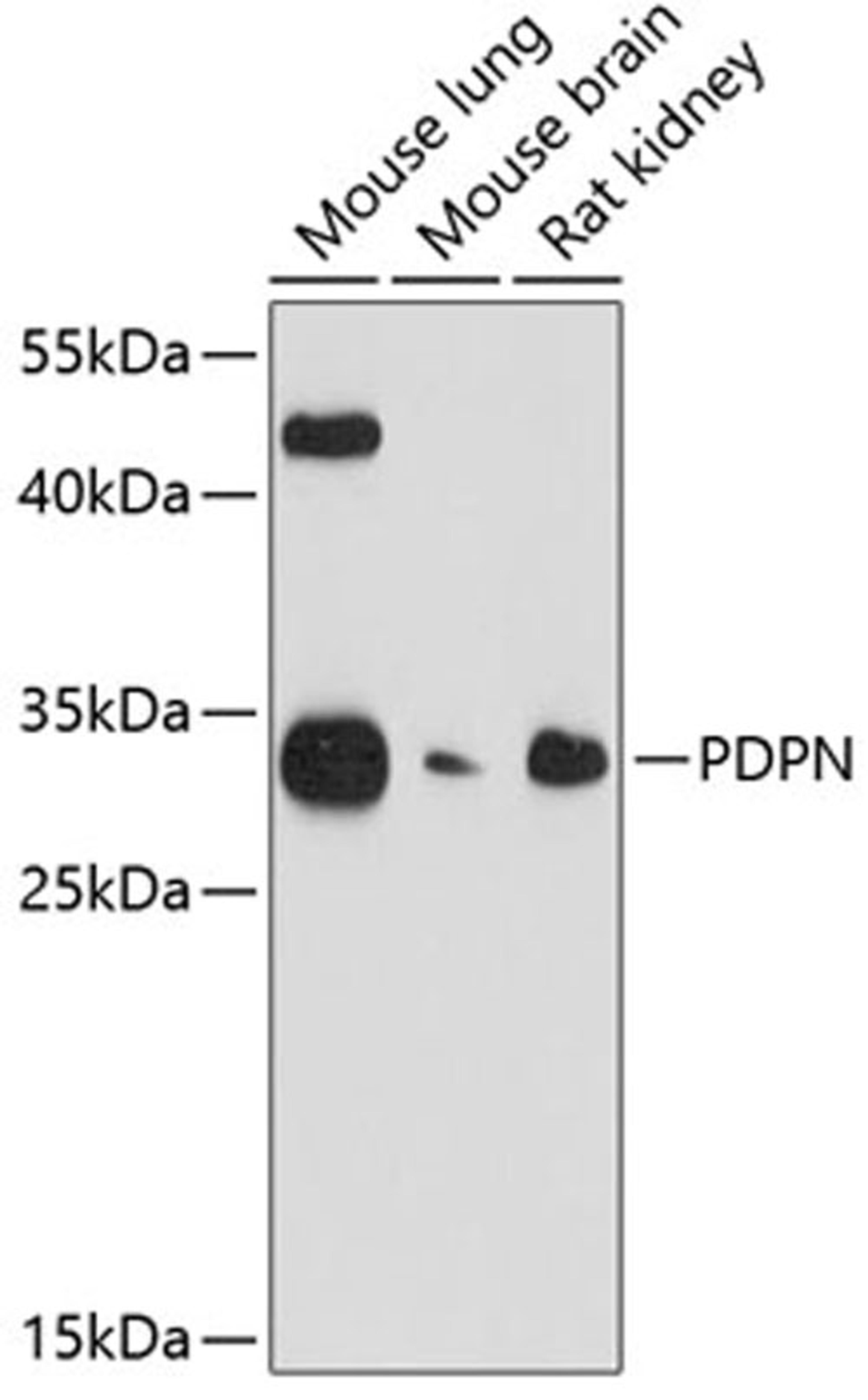 Western blot - PDPN antibody (A13261)