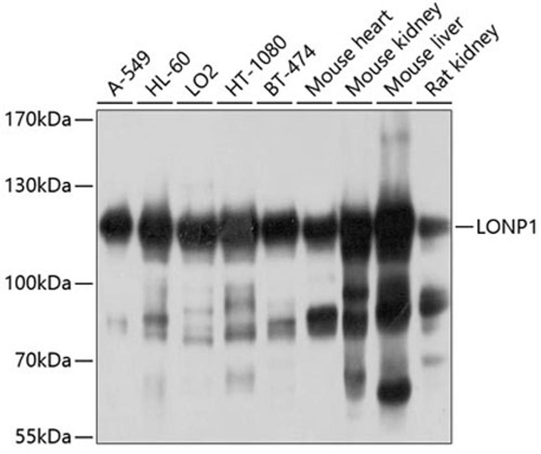 Western blot - LONP1 antibody (A4293)