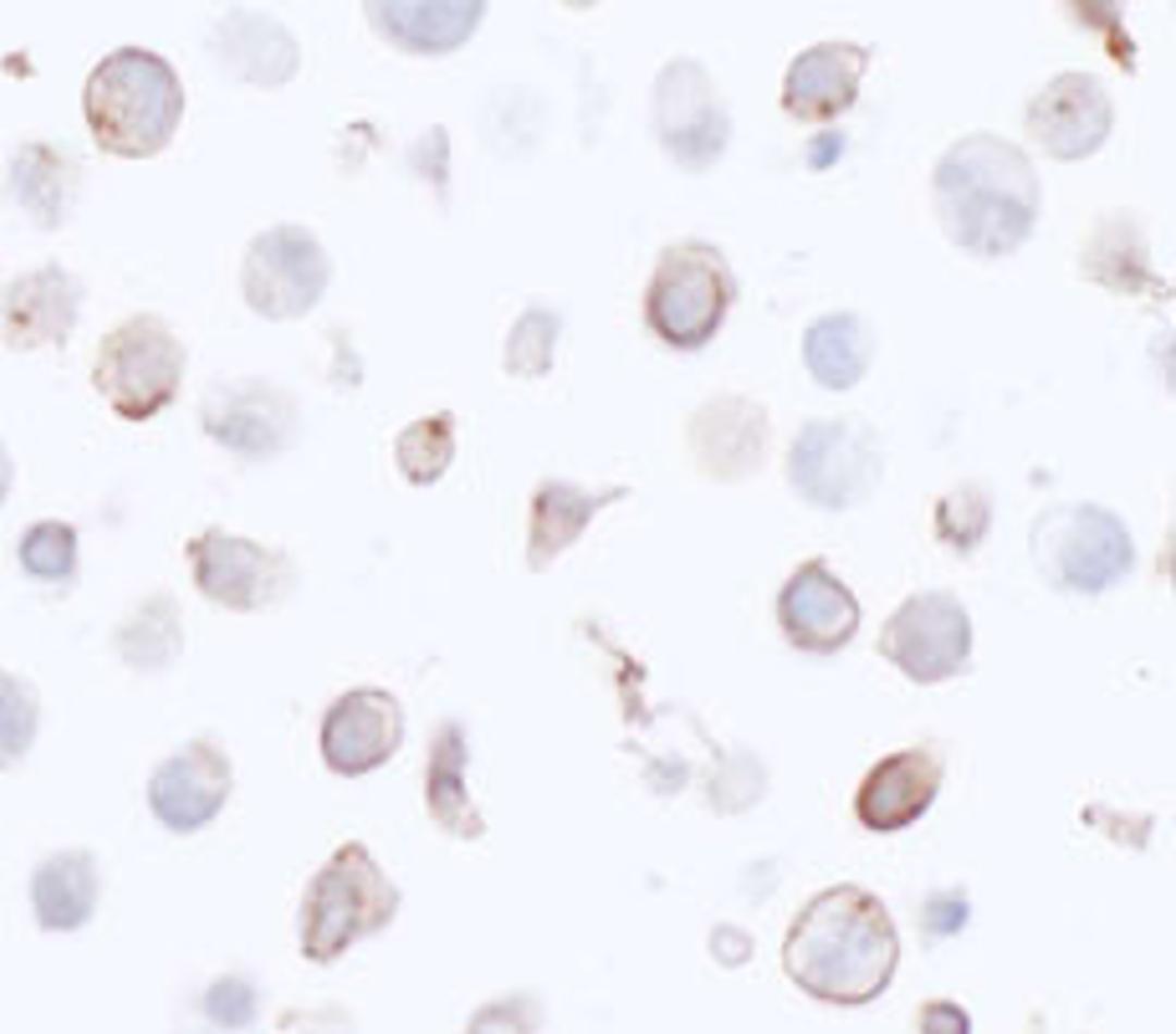 Detection of human HLA-DR by immunocytochemistry.