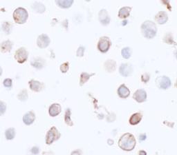 Detection of human HLA-DR by immunocytochemistry.