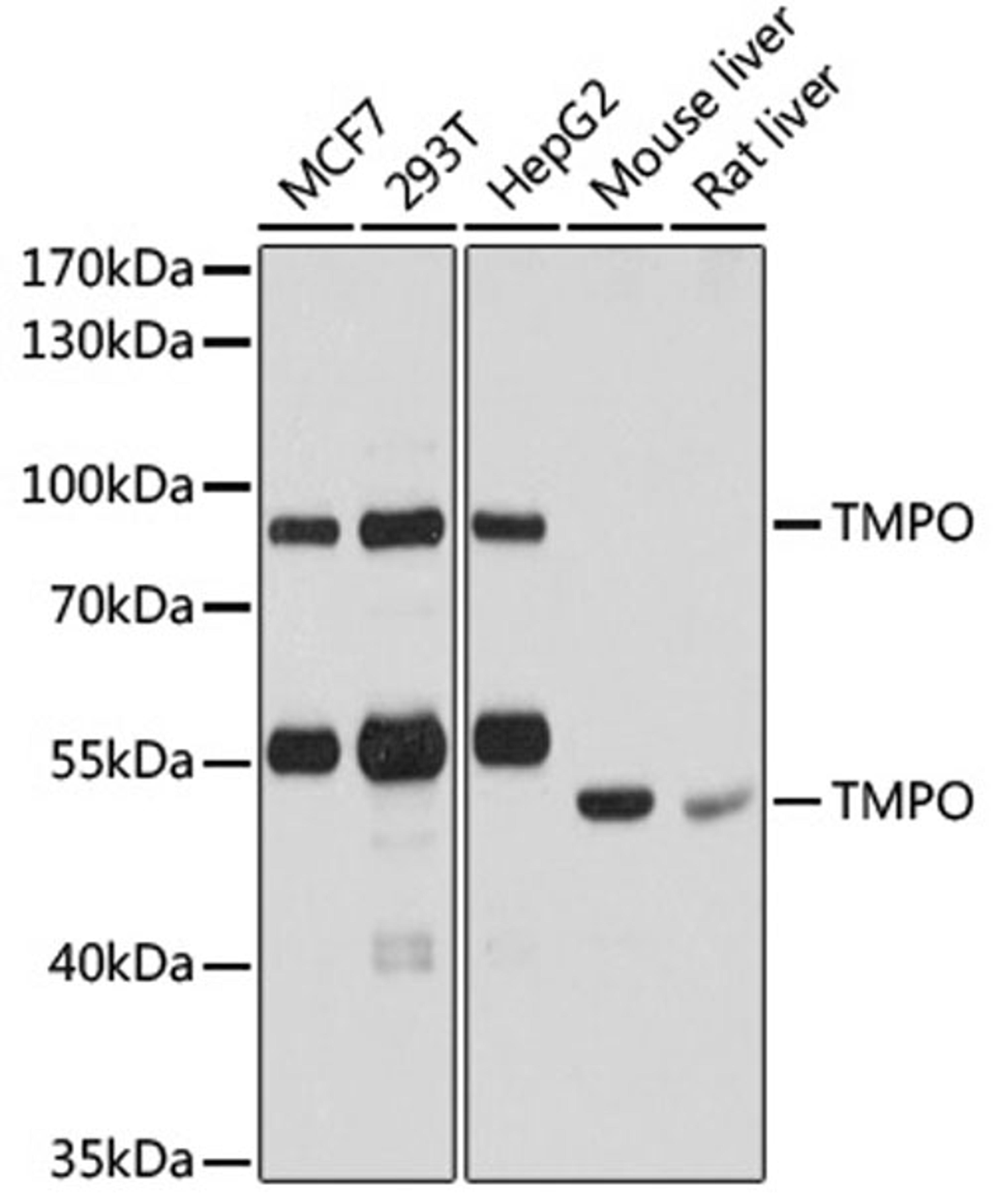 Western blot - TMPO antibody (A2534)