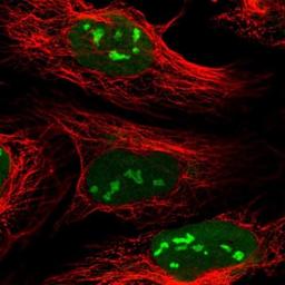 Immunocytochemistry/Immunofluorescence: C3orf26 Antibody [NBP1-81078] - Staining of human cell line U-2 OS shows positivity in nucleus & nucleoli.