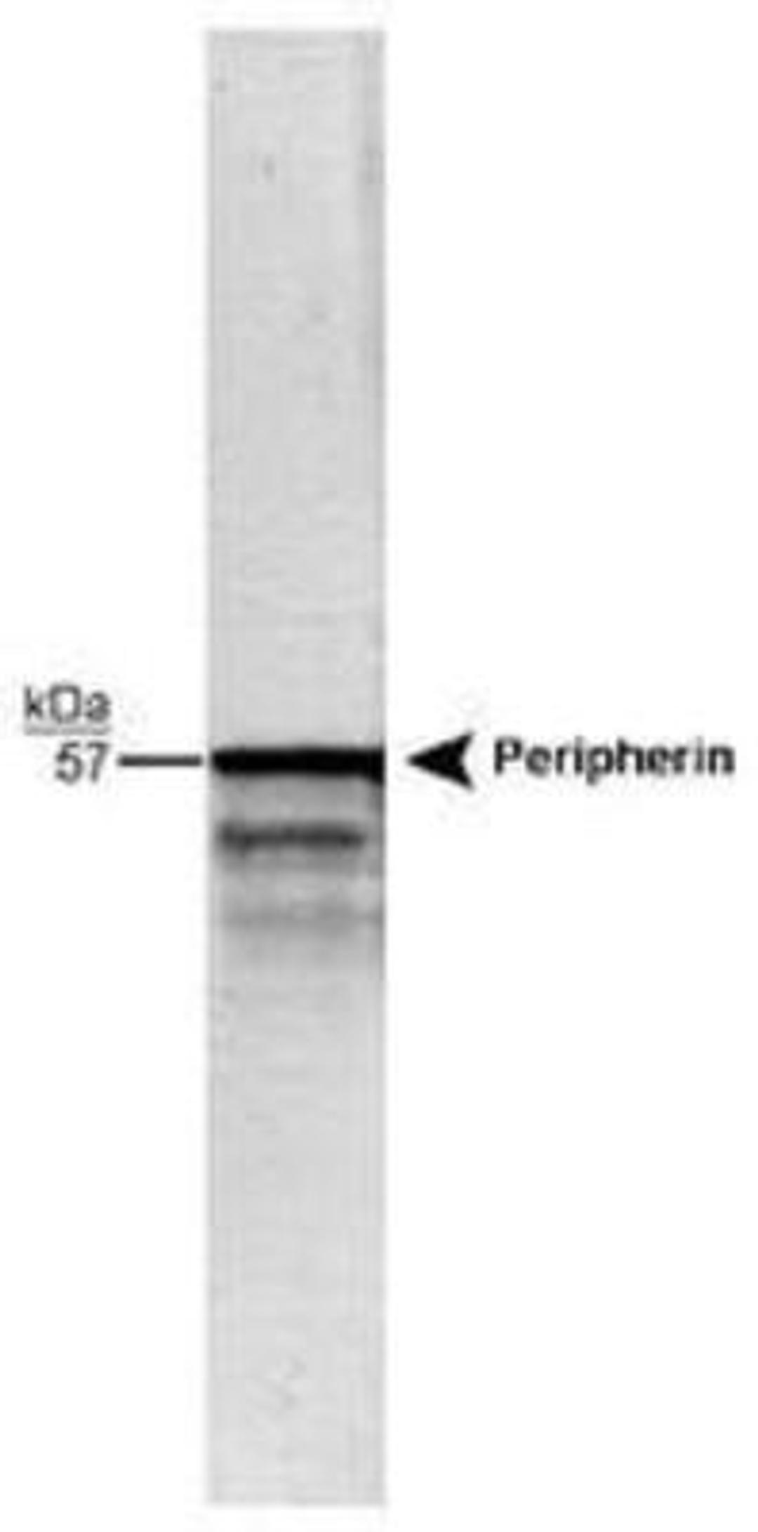 Western Blot: Peripherin Antibody [NB300-137] Detection of the 57 kDa peripherin protein in whole rat brain stem homogenate using NB 300-137 (1:20,000).  The faint 48 kDa band is a peripherin molecule.